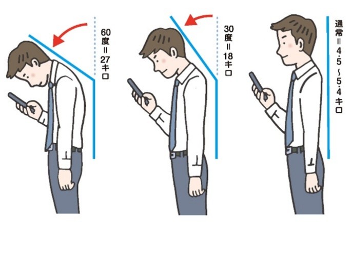 ストレートネック（スマホ首）｜北戸田ナノ整形外科泌尿器科クリニック